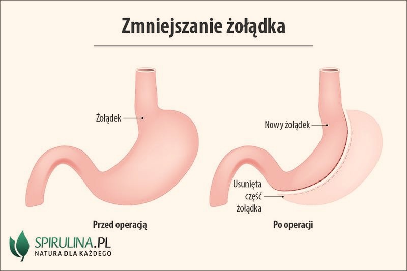 Skuteczne sposoby na to, jak zmniejszyć rozmiar zdjęcia w kilka chwil